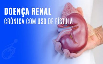 Doença Renal Crônica com uso de Fístula